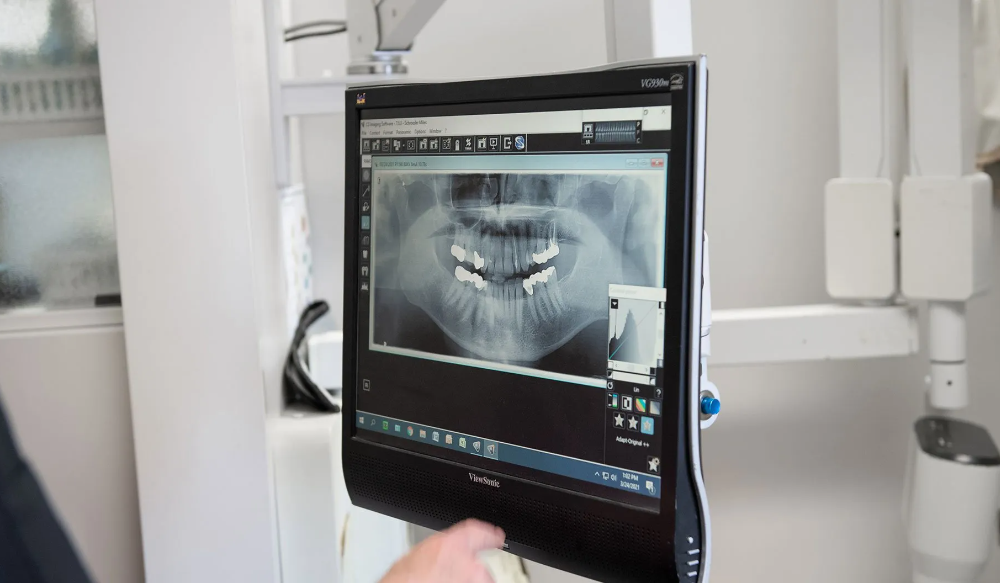 dental x rays