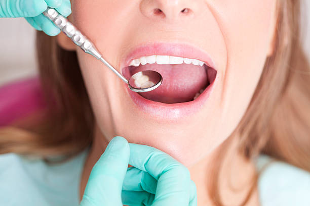 composite fillings check-up