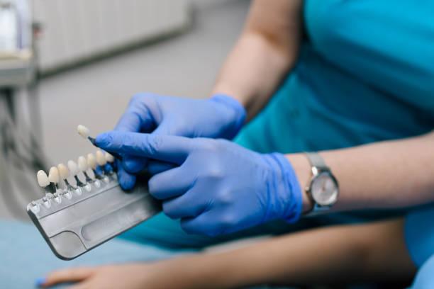 a dentist showing the dental veneer shades