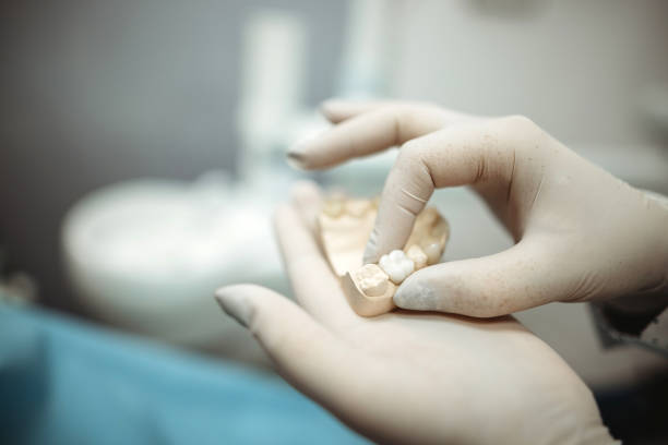 a pair of hands with gloves holding an implant mold