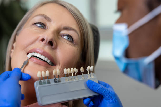 image of an elderly choosing from a palette of veneers